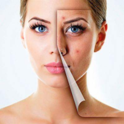 BEST BLEMISH TREATMENT - SavarnasMantra