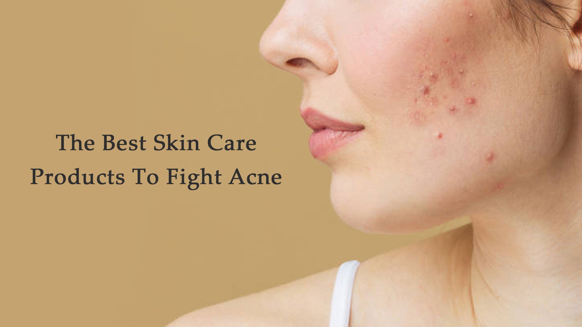 the-best-skin-care-products-to-fight-acne-savarnasmantra