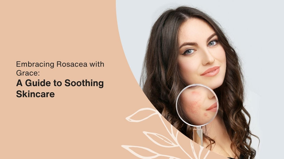 Embracing Rosacea with Grace: A Guide to Soothing Skincare