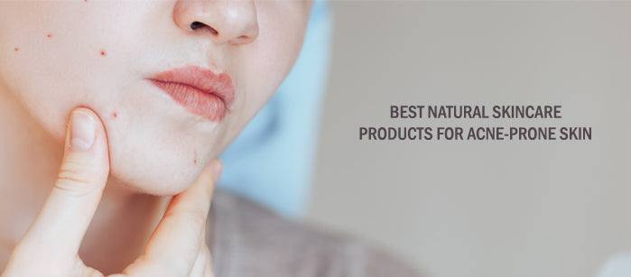 The Best Natural Skincare Products For  Acne-Prone Skin - SavarnasMantra