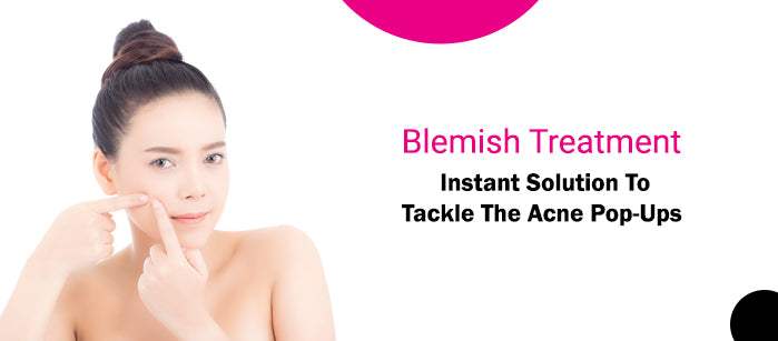 Blemish Treatment: Instant Solution to Tackle the Acne Pop-Ups - SavarnasMantra
