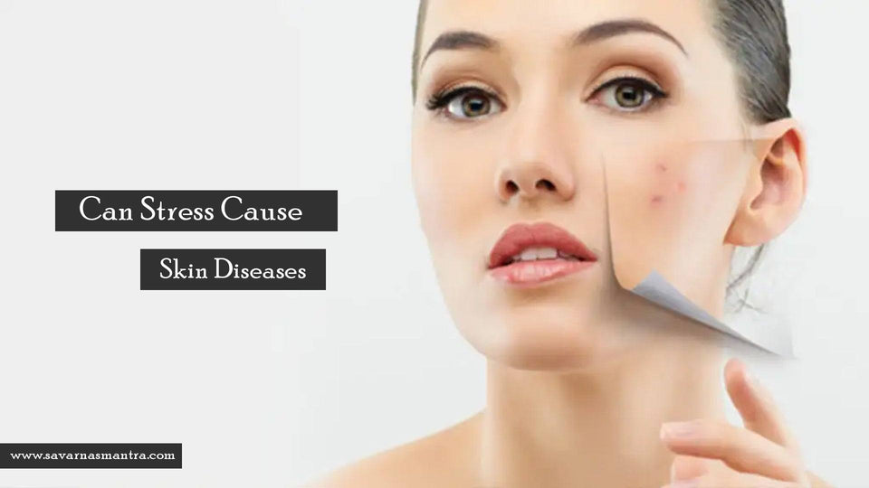 Can Stress Cause Skin Diseases? - SavarnasMantra