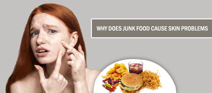 Why Does Junk Food Cause Skin Problems? - SavarnasMantra