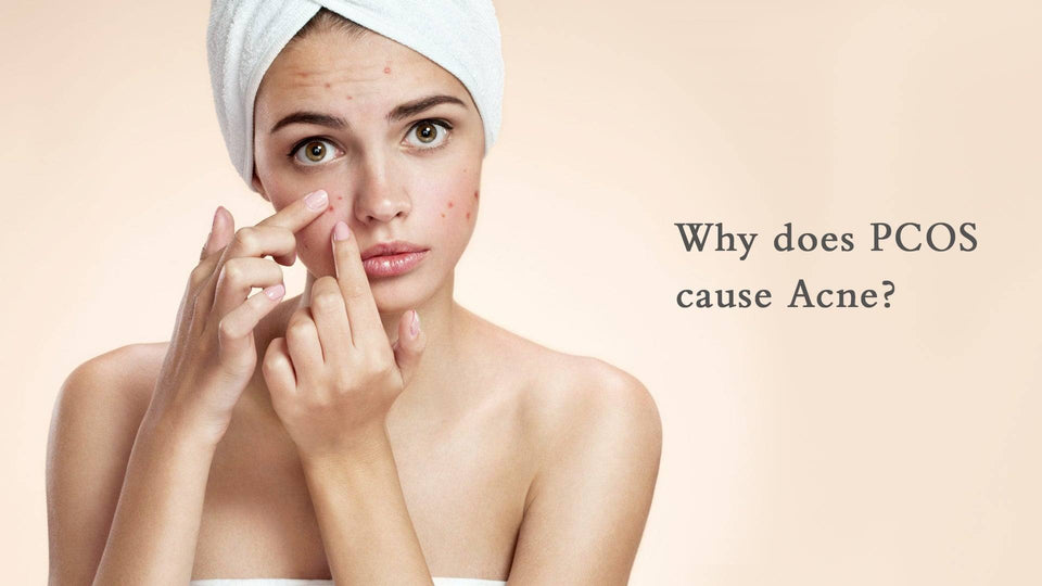 Why does PCOS cause Acne?