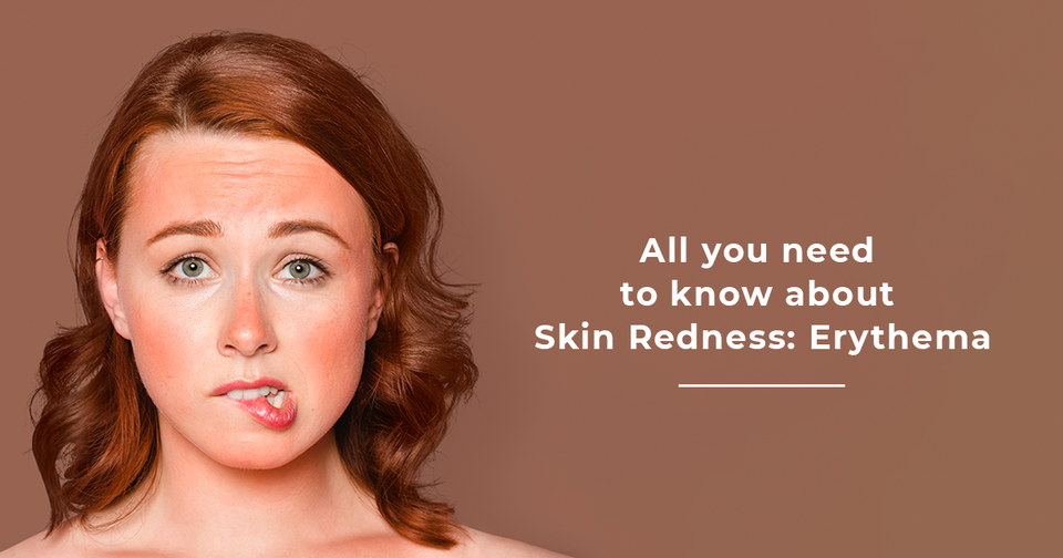 All you need to know about skin redness: Erythema