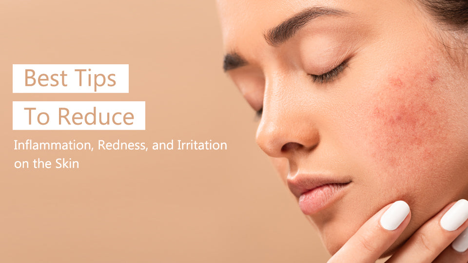 Best Tips to Reduce Inflammation, Redness, and Irritation on the Skin