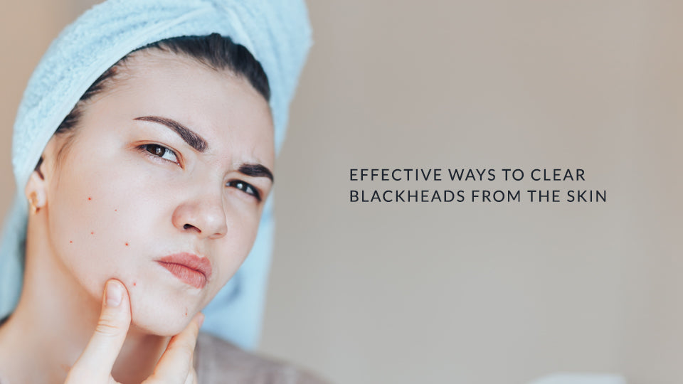 Effective Ways to Clear Blackheads from the Skin