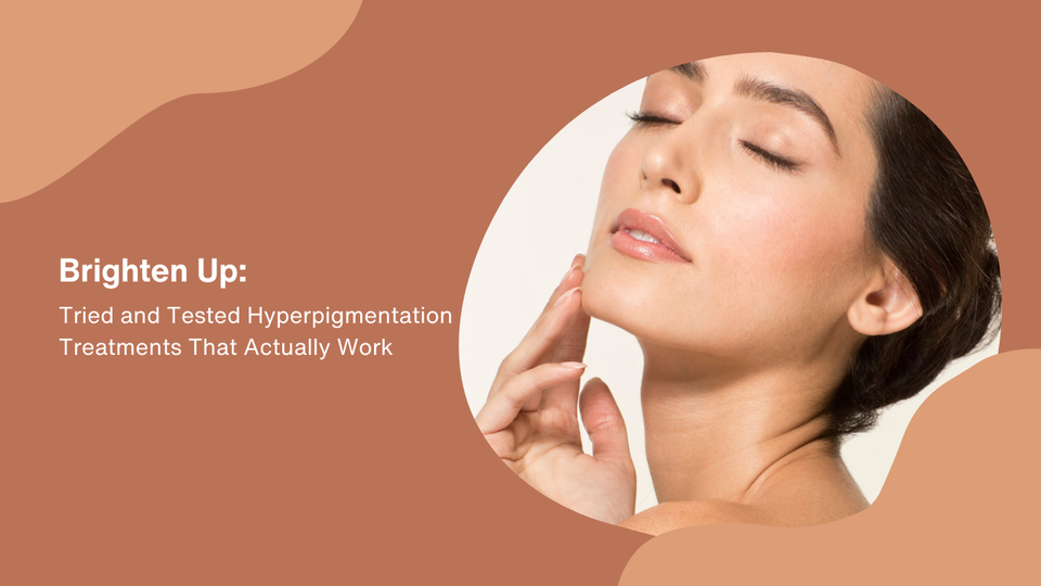 Brighten Up: Tried and Tested Hyperpigmentation Treatments That Actually Work