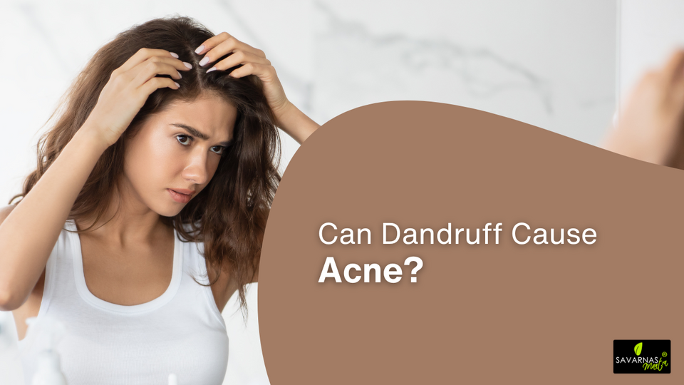 Can Dandruff Cause Acne?