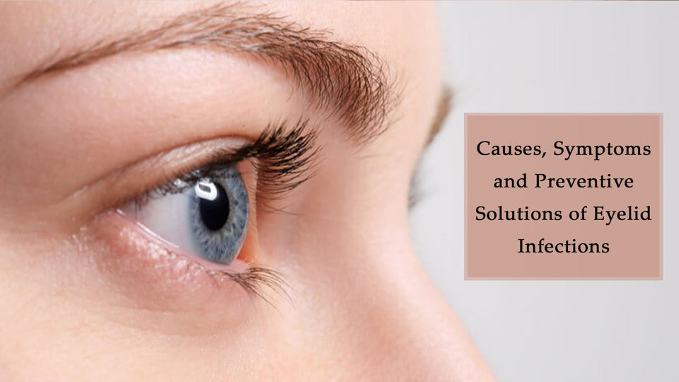 Causes, Symptoms and Preventive Solutions of Eyelid Infections