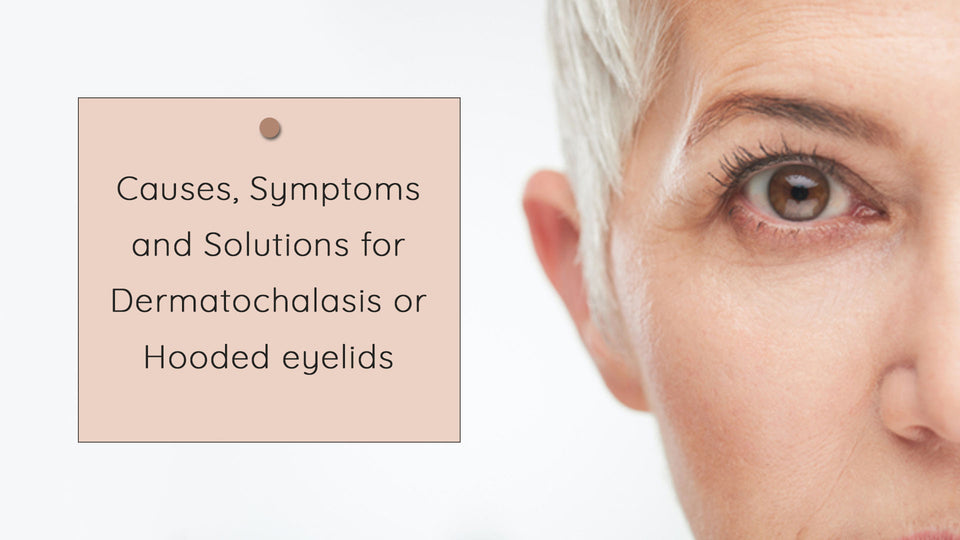 Causes, Symptoms and Solutions for Dermatochalasis or Hooded eyelids