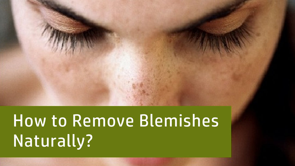How to Remove Blemishes Naturally?