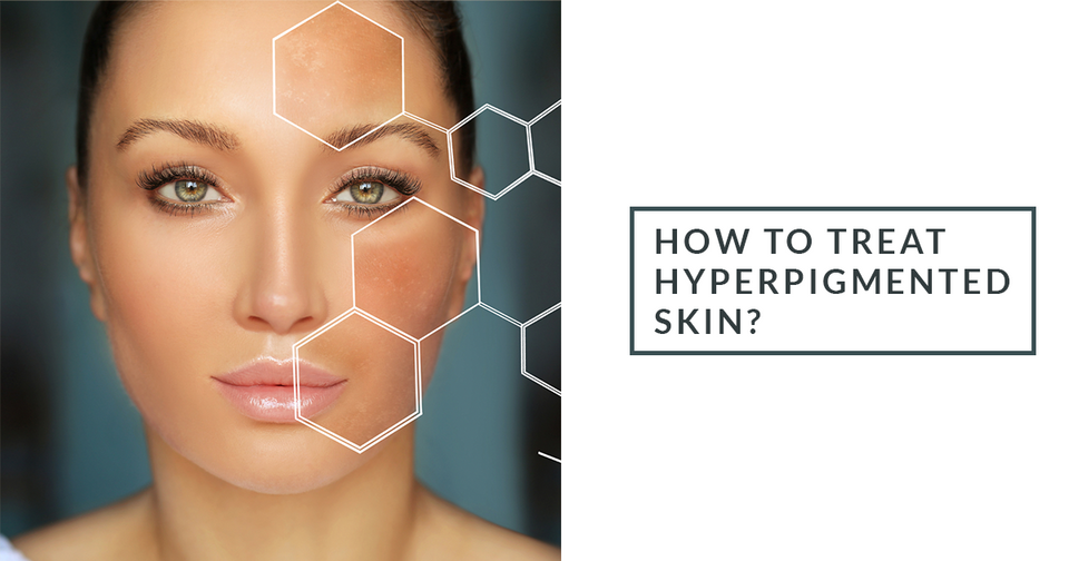 Hyperpigmented How to treat hyperpigmented skin?