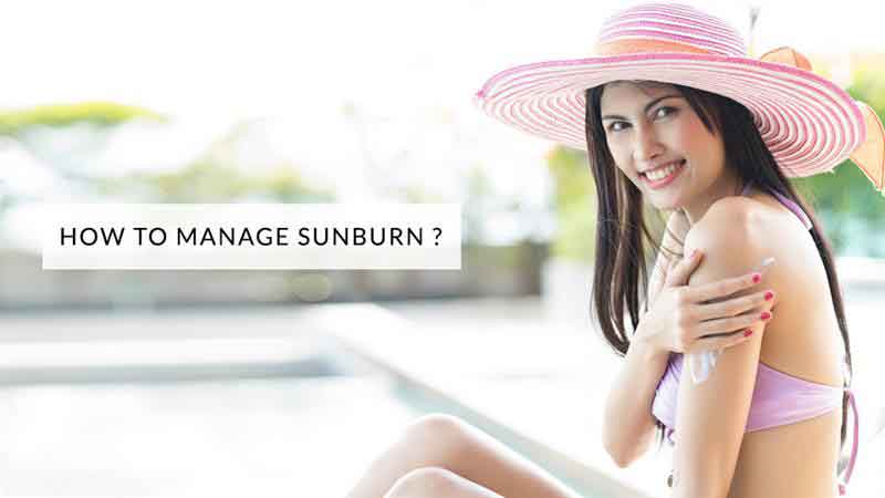 How to Manage Sunburn?