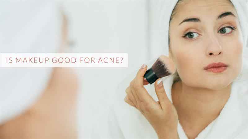 Is makeup good for acne?
