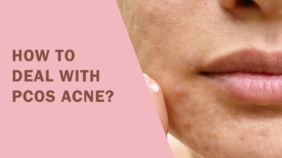 How To Deal With PCOS Acne?