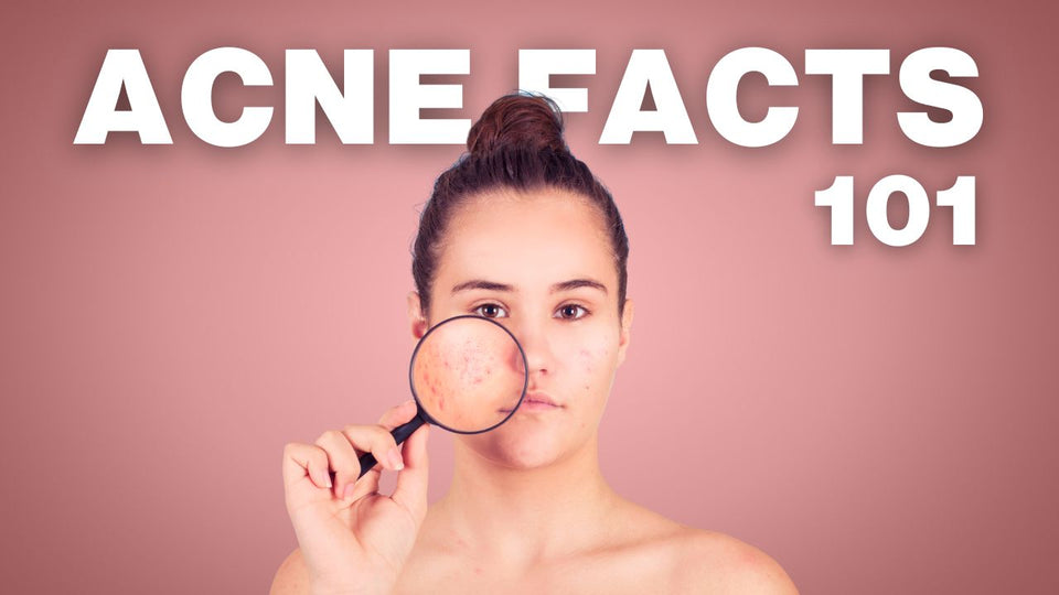 Acne Facts 101