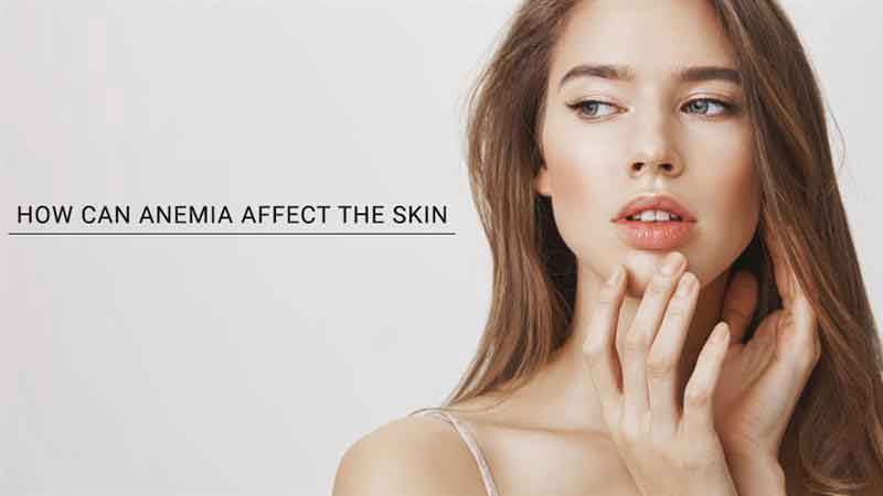 How can anemia affect the skin?