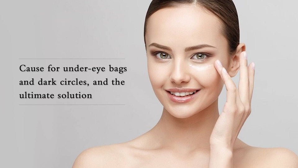Causes for Under Eye Bags and Dark Circles and the Ultimate Solution