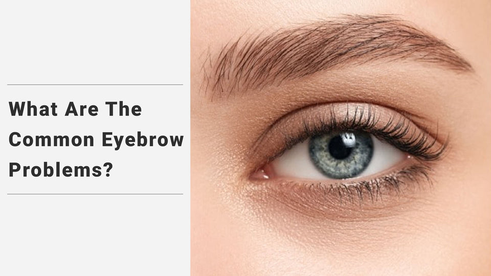 What Are The Common Eyebrow Problems?