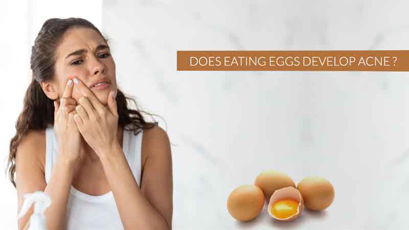 Does Eating Eggs Develop Acne?