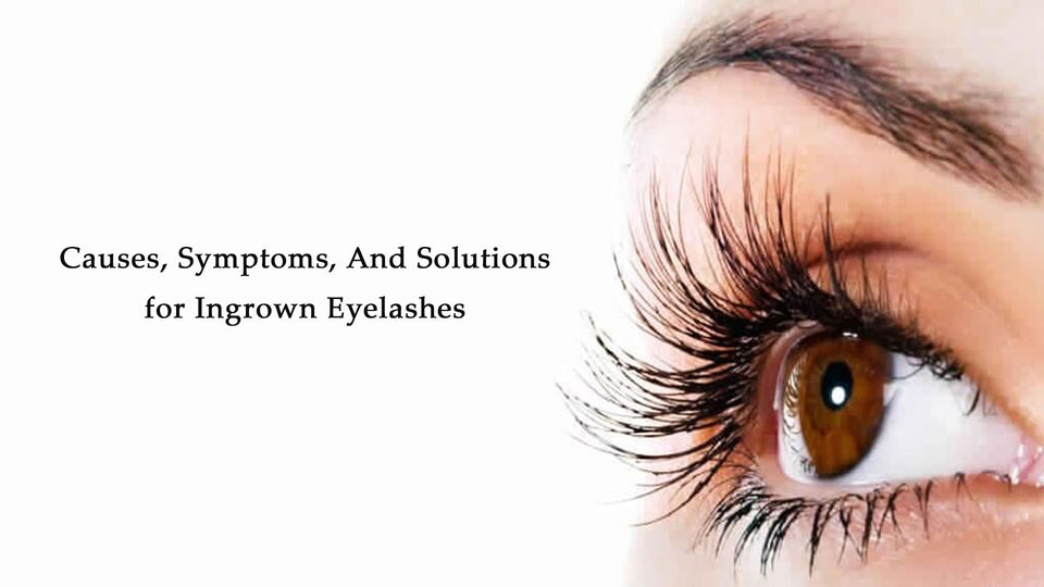 Causes, Symptoms, And Solutions for Ingrown Eyelashes